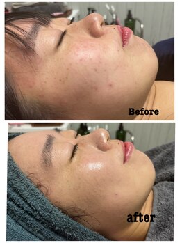 アスピリア(aspirer a')/老廃物もスッキリ！石膏パック◎