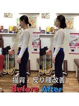 ヒデ整体院(Hide整体院)/猫背矯正骨盤矯正B/A肩こり腰痛