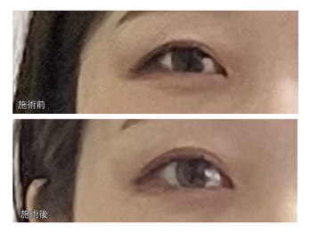 タイナ 岡山(taina)/小顔矯正