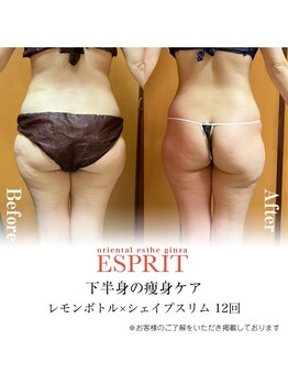 エスプリ 銀座店/レモンボトル×シェイプスリム