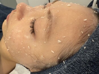 ロイヤル ビューティー サロン(Royal Beauty Saloon)の写真/【韓国セルマンで肌質管理×ピーリング】美白ケア効果◎ナイアシドアミド配合水分量UP/ニキビケア/毛穴レス