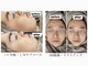 ココン(cocon)の写真