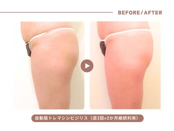 イエス マイサロン(yes My Salon)/自動筋トレマシンBIJIRIS施術例