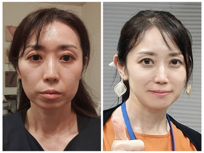 リフティア 戸田公園店(LIFTIER)の写真