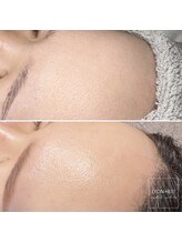 リヨン(LYON+831)/