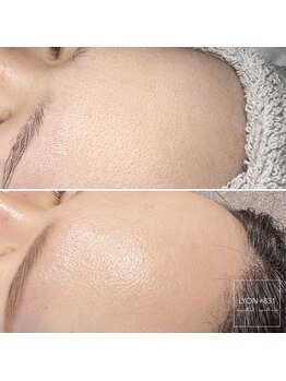 リヨン(LYON+831)/