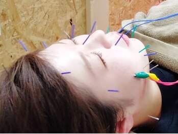 ほぐしてコリとる/美容鍼パルスでリフトアップ