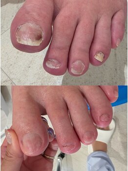 ハビッツ(habits)/メンズ爪切り