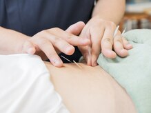 安井鍼灸接骨院 松葉公園院