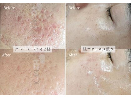 シューラディアント(ShuRadiant)の写真