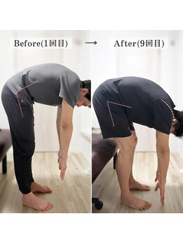 ジェイミープラス 表参道(J‘aimee +)/スポーツ整体ビフォーアフター