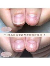 ジェル育成
