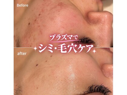 ココビ(COCOVi)の写真