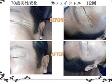 磨凛/光フェイシャル変化