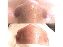チアリス(chiariss)の雰囲気（【毛穴洗浄】小顔ケア/毛穴洗浄/むくみケアなどを改善！）