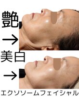 フロレゾン(Floraison)/フェイシャル幹細胞エクソソーム