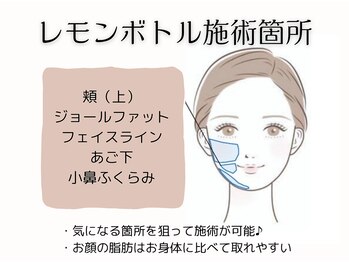 ヌナ(NOONA)/レモンボトル[小顔]