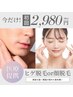 【ヒゲ脱毛/顔脱毛】☆医療提携☆他店で満足できなかった方　¥6,600→¥2,980