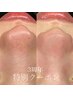 【3周年記念クーポン♪】お鼻の毛穴洗浄×お鼻のポイントwax ¥6320→￥4980