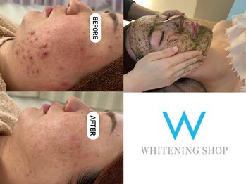 ルヴィ うるま店(REVI)