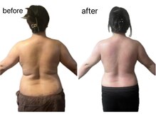 ライズサロン(RiseSALON)の雰囲気（見た目痩せに特化した痩身リンパマッサージ）