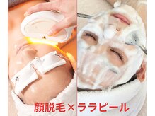 顔脱毛+ララピール【最高峰の毛穴レス、ツヤ肌！ニキビケア】