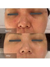 マインエム(mine.m)/SEN管理→VVS