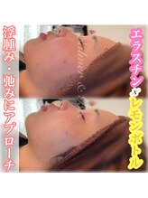 カルマーアンドビー(Calmer & Be.)/【レモンボトル】Before／After