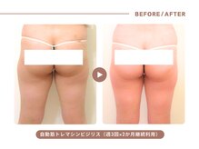 イエス マイサロン(yes My Salon)/自動筋トレマシンBIJIRIS施術例