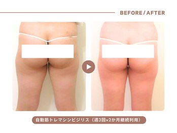 イエス マイサロン(yes My Salon)/自動筋トレマシンBIJIRIS施術例