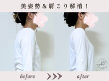 エーアール(AR)