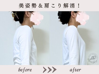 エーアール(AR)の写真
