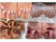 ピュアネイルアンドオンディーヌの写真/定額メニューで安心♪32年の実績と豊富なカラー、マグネットを揃えネイルが初めてにもオススメです！