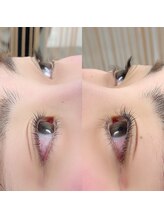 プライベートサロン アンジュ(Private Salon Ange)/セラムラッシュリフト・下まつ毛