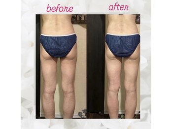 ヨサパーク エトワール 聖蹟桜ヶ丘店(YOSAPARK)/before、after♪