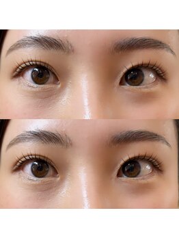 フィービー(pheebe)/マシュマロロッド♪