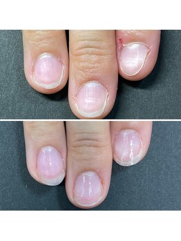 爪の形は変えられる