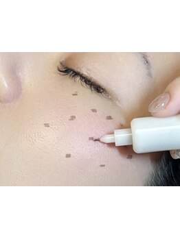 シミしわ改善！予防ケア