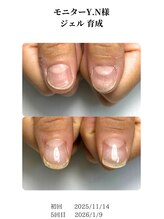 ノイルム(noilm)/爪質改善