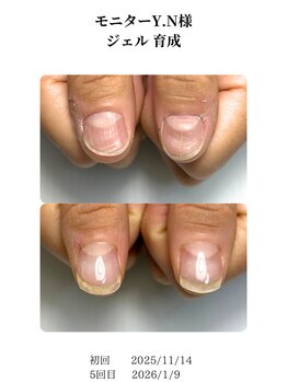 ノイルム(noilm)/爪質改善