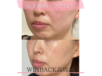 タルボ(TALBO)の写真