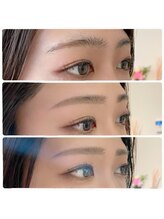 アンバーレス(AmberRes)/お客様 BeforeAfter