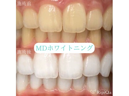 リピカ(RipiQa)の写真