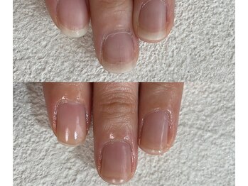 縦長の美爪になりたい