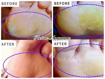 レーヌ青山(Reine Aoyama)の写真