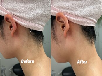 クイーン 渋谷店(QUEEN)/もみあげと繋がる前に