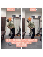 アンティオール 上野店/Before→After