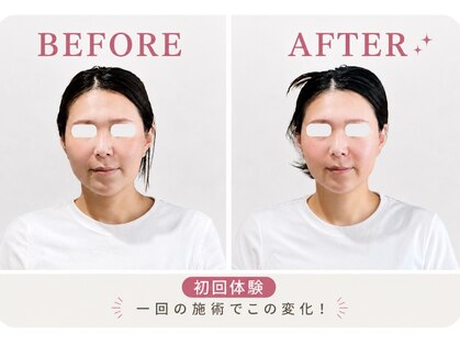リフェイス(RE:FACE)の写真