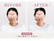 リフェイス(RE:FACE)の写真