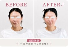 リフェイス(RE:FACE)
